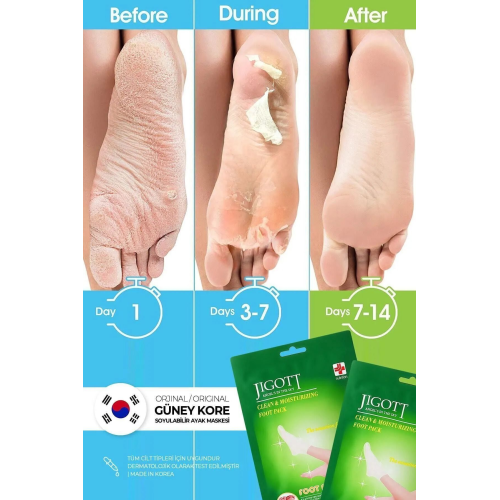 Çorap Tipi Soyulan Ayak Peeling Maskesi - Miracle Foot Peeling Pack