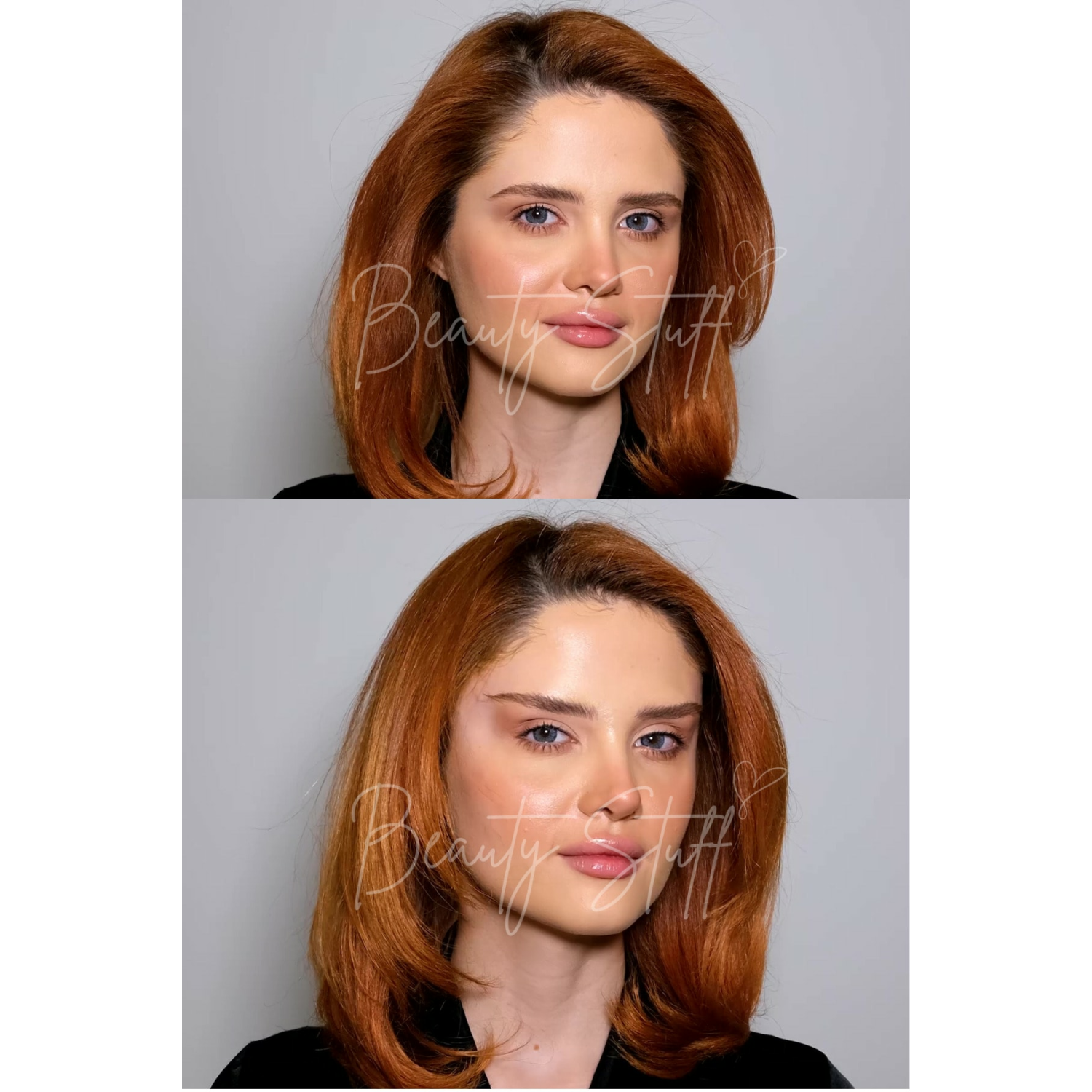 BEJ LASTIKLI Lift 'Em Up Yüz & Göz Germe Bantları (20'li paket) (Made in USA)