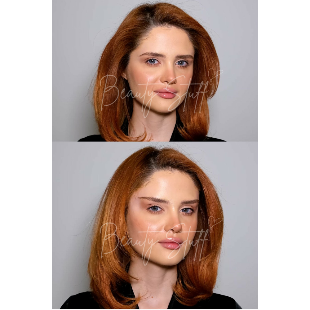 Siyah Lastikli Lift 'Em Up Yüz & Göz Germe Bantları (20'li paket) (Made in USA)