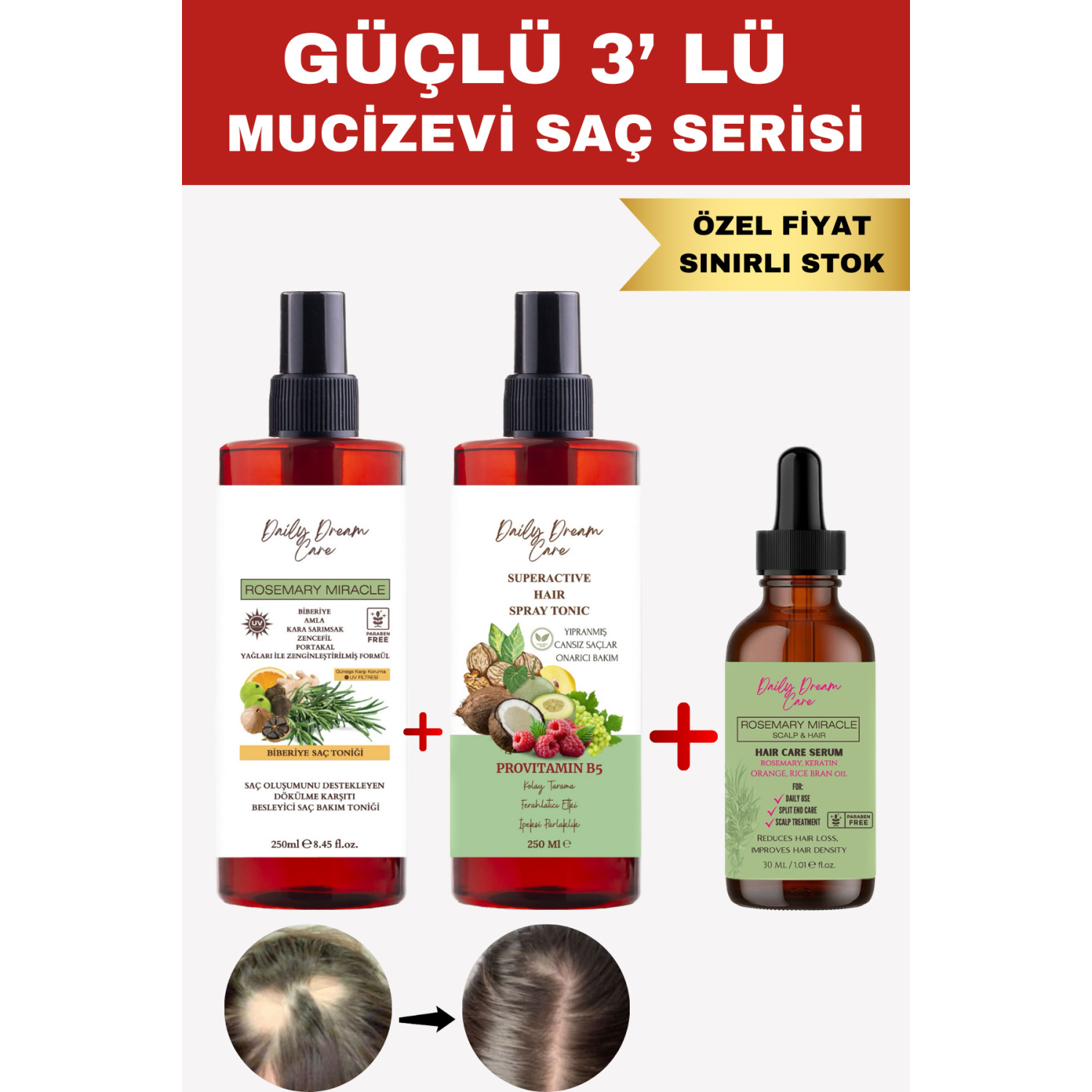 Daily Dream Care Güçlü 3’Lü Mucizevi Saç Seti Biberiye Tonik+Sirkeli Tonik + Biberiye Kompleks Yağ
