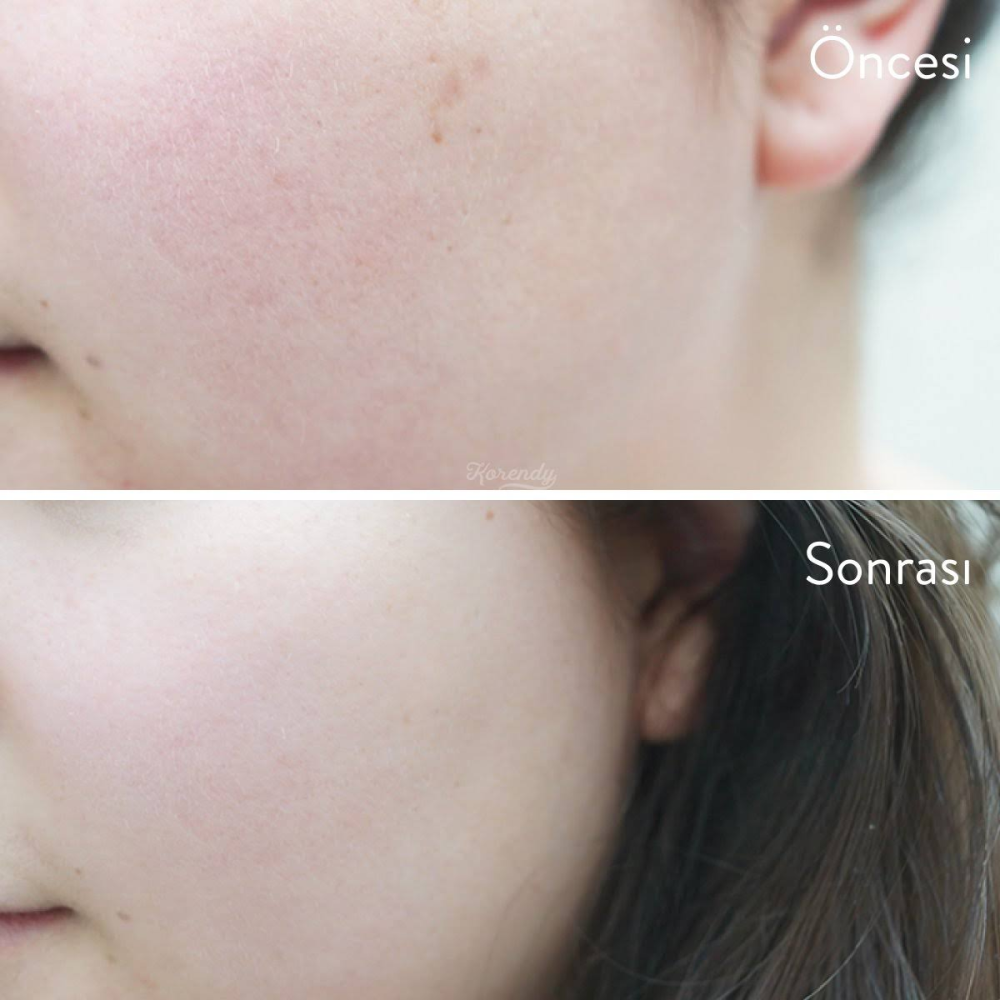 Cosrx AHA/BHA Clarifying Treatment Toner